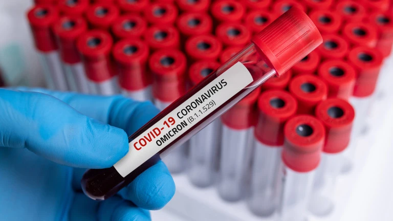 1442 са новите болни от коронавирус през последните 24 часа,