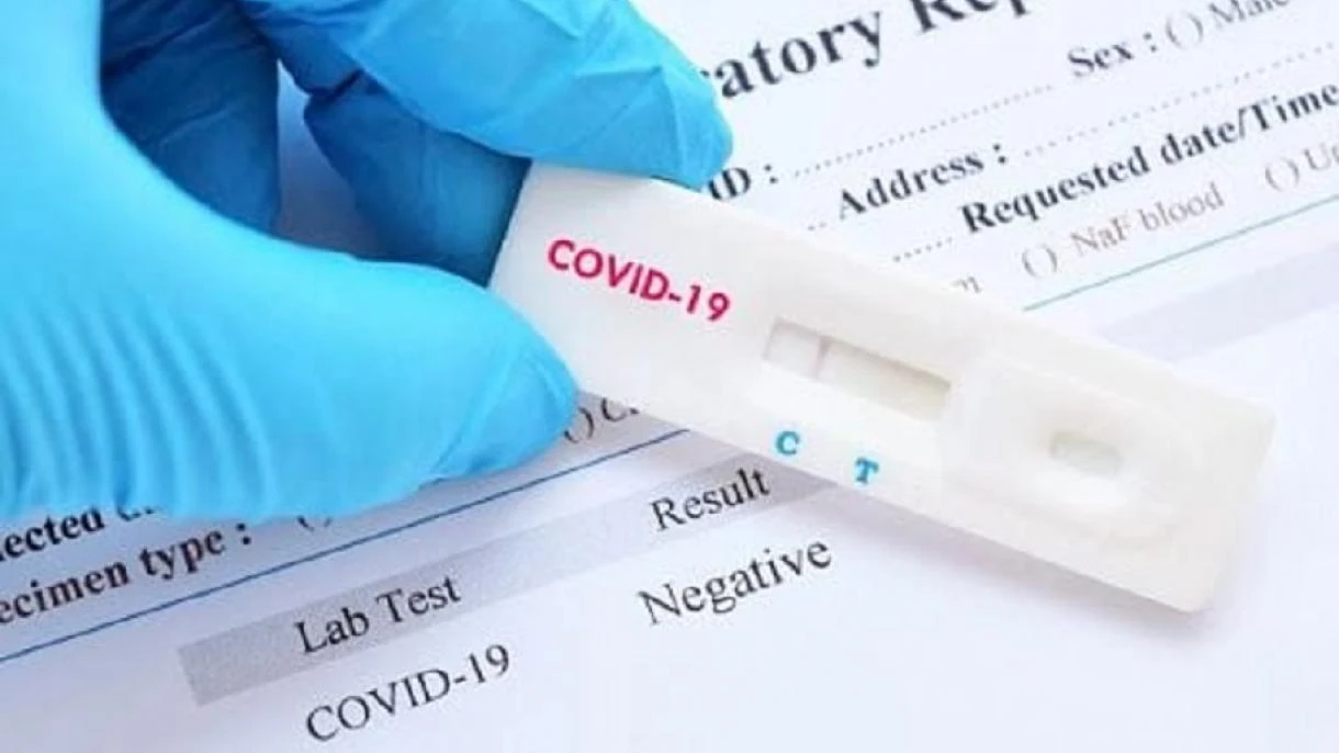 726 са новите случаи на Covid-19 у нас за последното