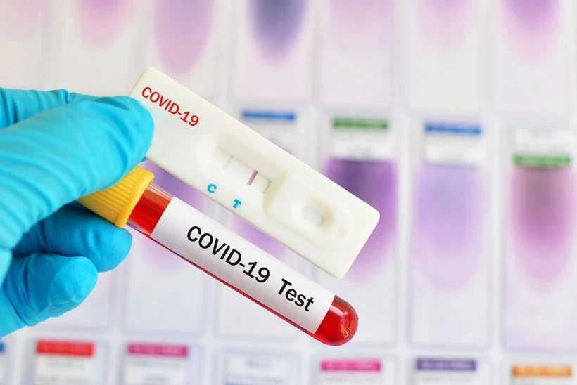 265 са новите случаи на коронавирус у нас за последните