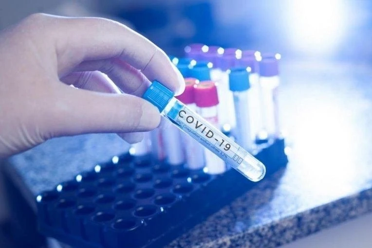 381 са новите случаи на коронавирус в България, показват данните