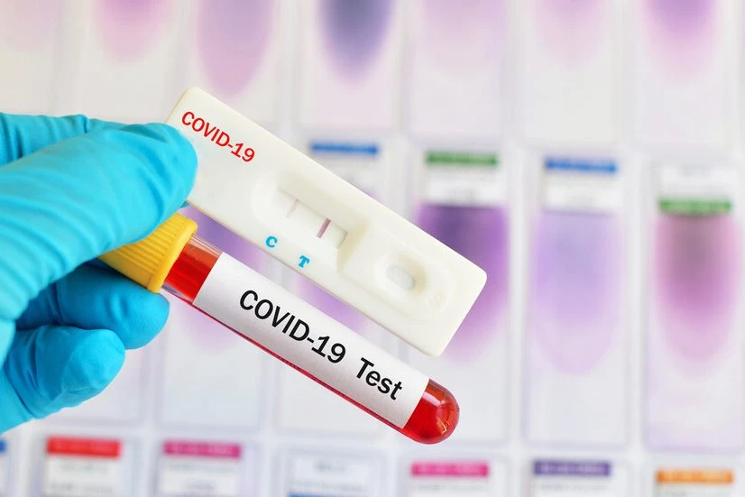 Новите случаи на коронавирус у нас са 538, сочат данните на