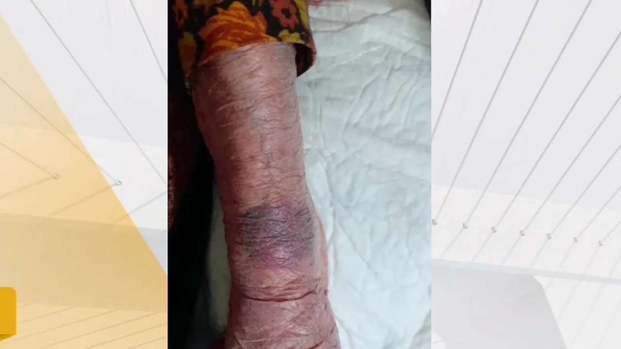 Снимка: Твърдения за насилие над 104-годишна пациентка във Видин: От МЗ започват проверка по случая