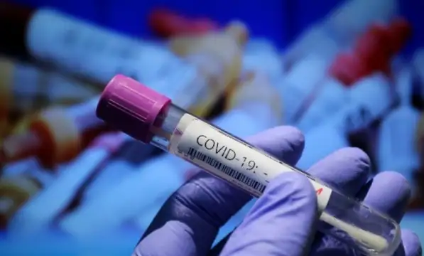 6278 са новите случаи на коронавирус през изминалото денонощие Направени