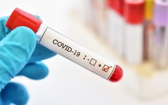 1388 са новите случаи на коронавирус у нас през последното