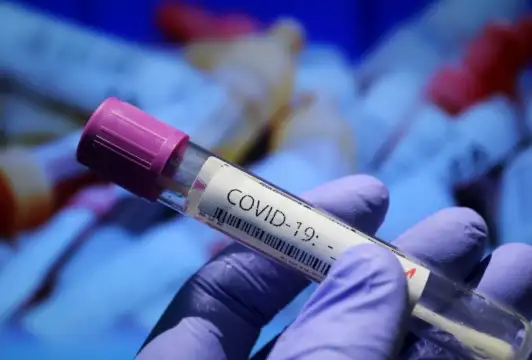 523 са новите случаи на коронавирус през последното денонощие при