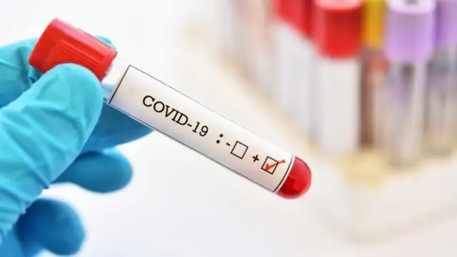 704 са новите случаи на коронавирус в България за изминалото