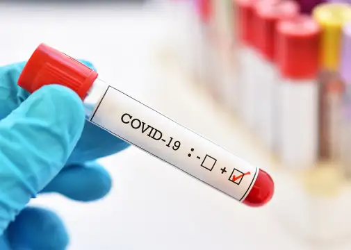1698 са новите случаи на коронавирус за изминалото денонощие показват