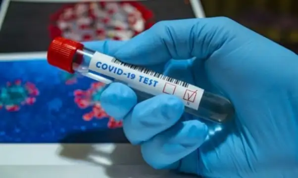 715 са новооткритите заразени с COVID 19 в страната като 67 13