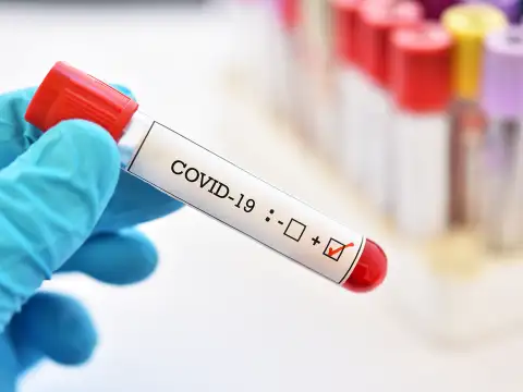 550 са новите случаи на коронавирус у нас за последното