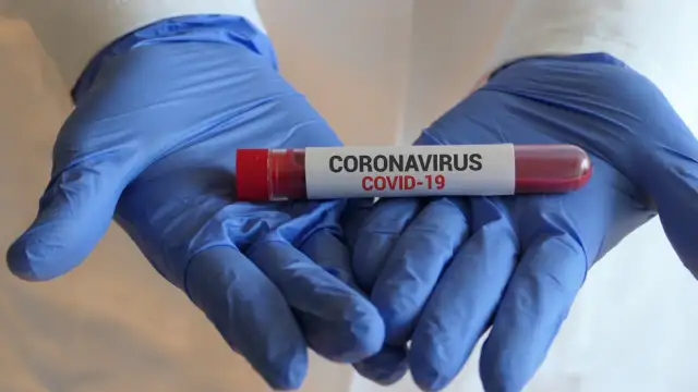 263 са новите случаи на коронавирус у нас за последните