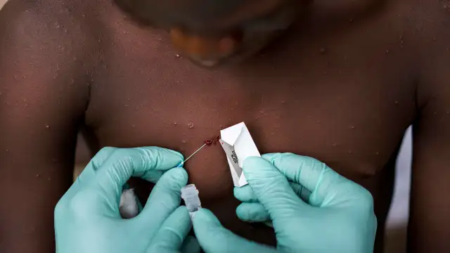 Европейските държави ще бъдат приканени да подготвят ваксинационен план за