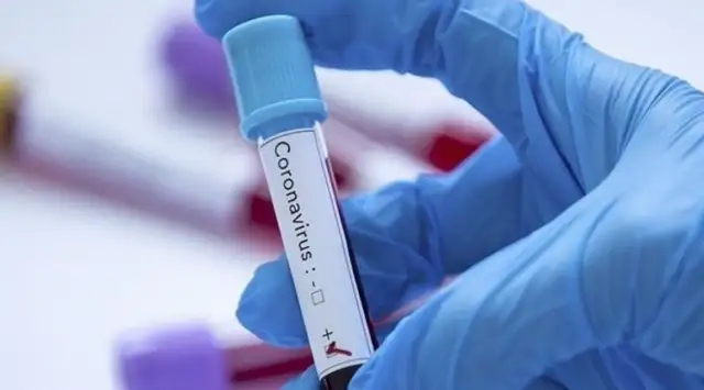 80 са новите случаи на коронавирус у нас за последните