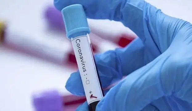 168 души са се заразили с коронавирус двама са починали