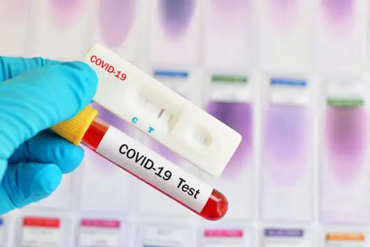 Новите случаи на коронавирус у нас са 538 сочат данните на