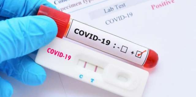 411 нови случая на COVID 19 са регистрирани у нас за