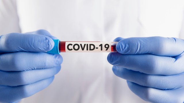 Новите случаи на COVID 19 у нас за последното денонощие са