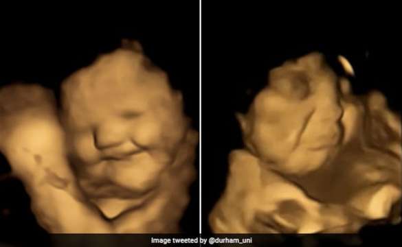 Бебетата в утробата реагират на това което майките им ядат