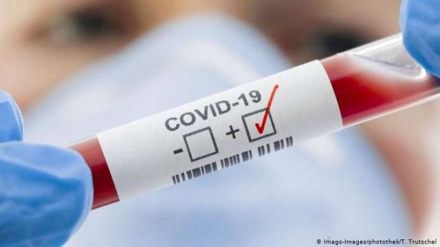 Новите потвърдени случаи на COVID 19 у нас за последните 24 часа са 577