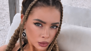 „Мис Вселена“ разказа за неуспешна естетична процедура