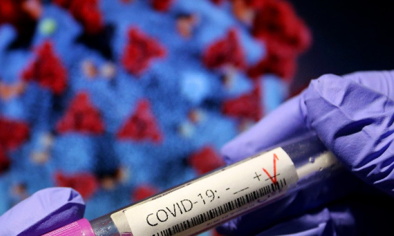 44 нови случая на коронавирус у нас