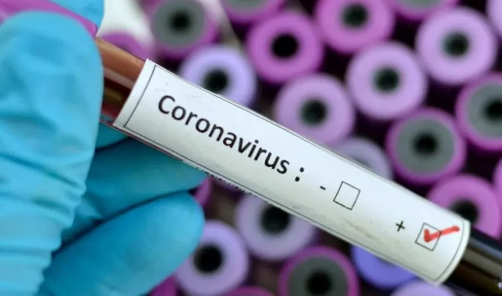 255 новозаразени с COVID-19, четирима са починали