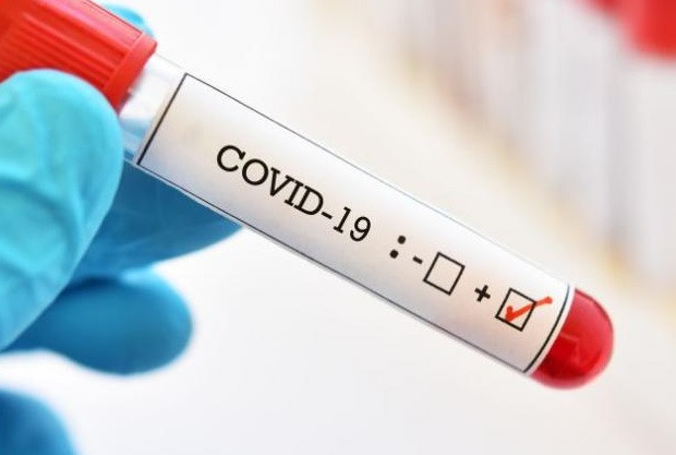 448 са новите случаи на COVID-19