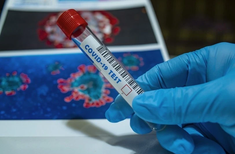 6589 са новите случаи на коронавирус у нас