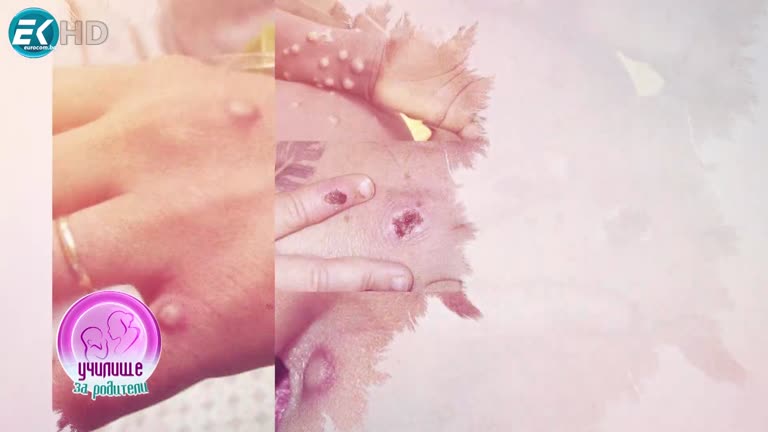 Маймунска шарка